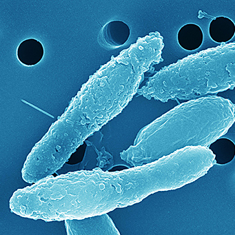 Clostridium butyricum NT (Isolated from adult human) 